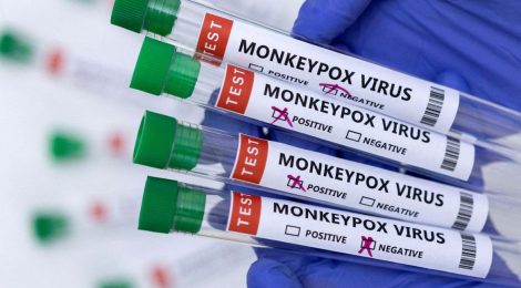 Casos de varíola dos macacos chegam a 76 em todo o país
