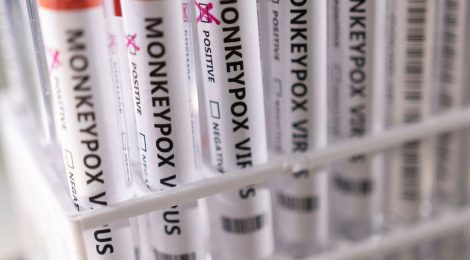 Varíola dos macacos: com 813 casos, Brasil tem situação "preocupante"