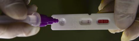 Casos de covid-19 no Rio de Janeiro aumentam 430% em uma semana