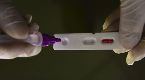 Casos de covid-19 no Rio de Janeiro aumentam 430% em uma semana